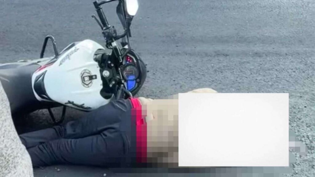 Le-disparan-en-la-cabeza-por-no-entregar-su-motocicleta-en-Escuintla